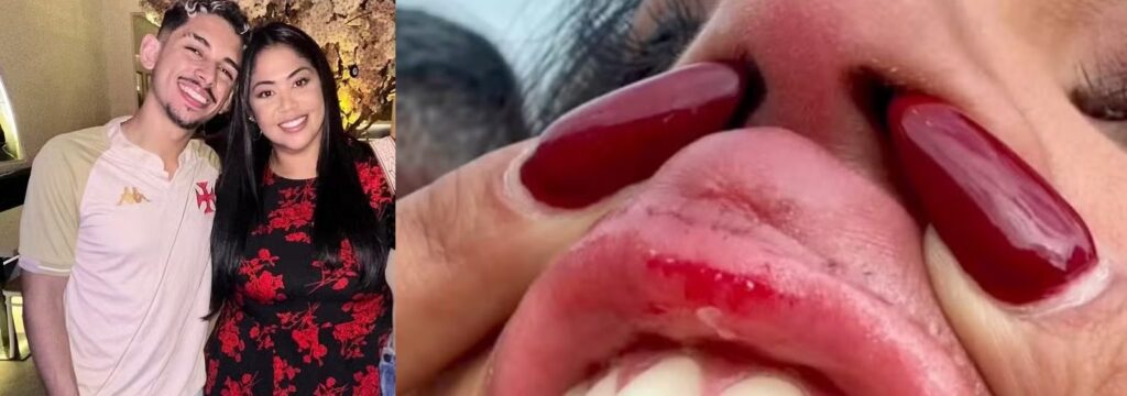 Ex-cunhado de cantora gospel é morto a tiros em Campo Grande