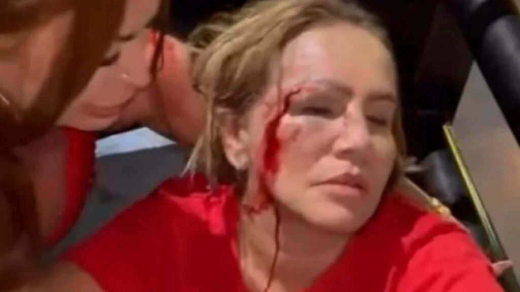 Vereadora do PT é atingida por tijolo em carreata pró-Lula